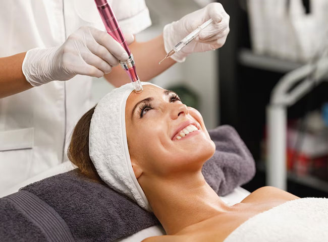 Microneedling