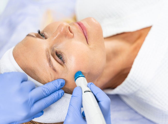 Microdermabrasion